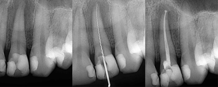 Centre De Micro Endodontie Et De Parodontie
